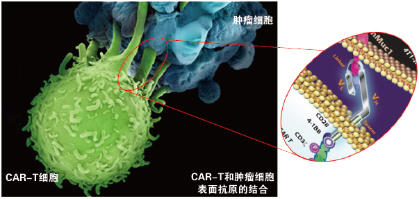 CAR-T00.png CAR-T00.png