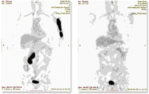 CAR-T02.png CAR-T02.png